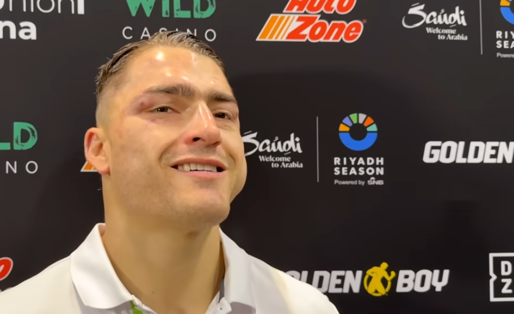 ออสการ์ ดูอาร์เต้ ตื่นเต้นกับไฟต์ชิงแชมป์กับ ริชาร์ดสัน ฮิทชินส์